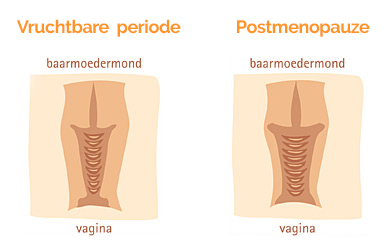 Vaginale droogheid verschillende periodes